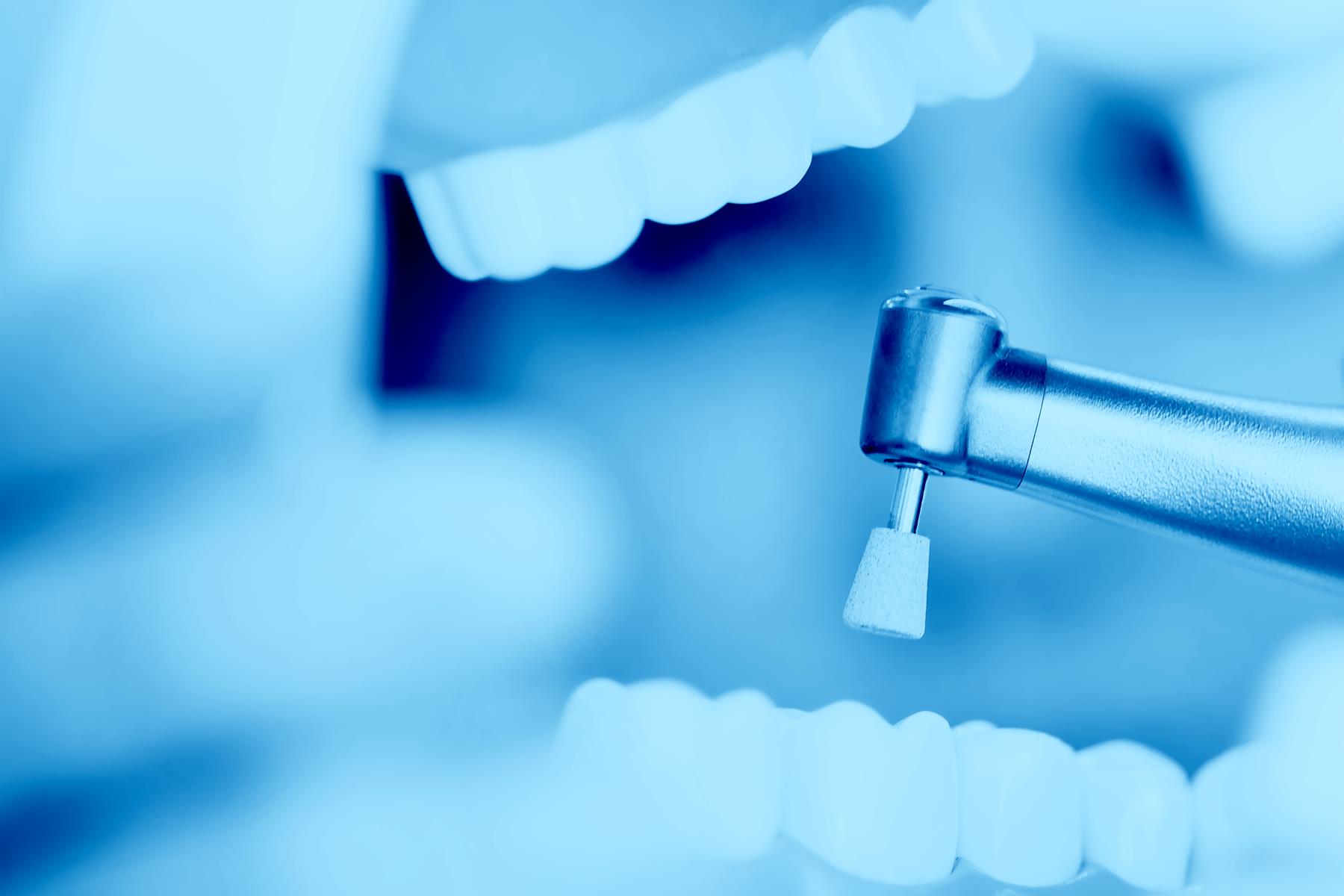 Curatatre dentara profesionala Natural SMIle